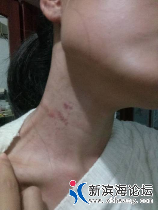 140813zb2vftpvkf2v15ev.jpg.thumb.jpg