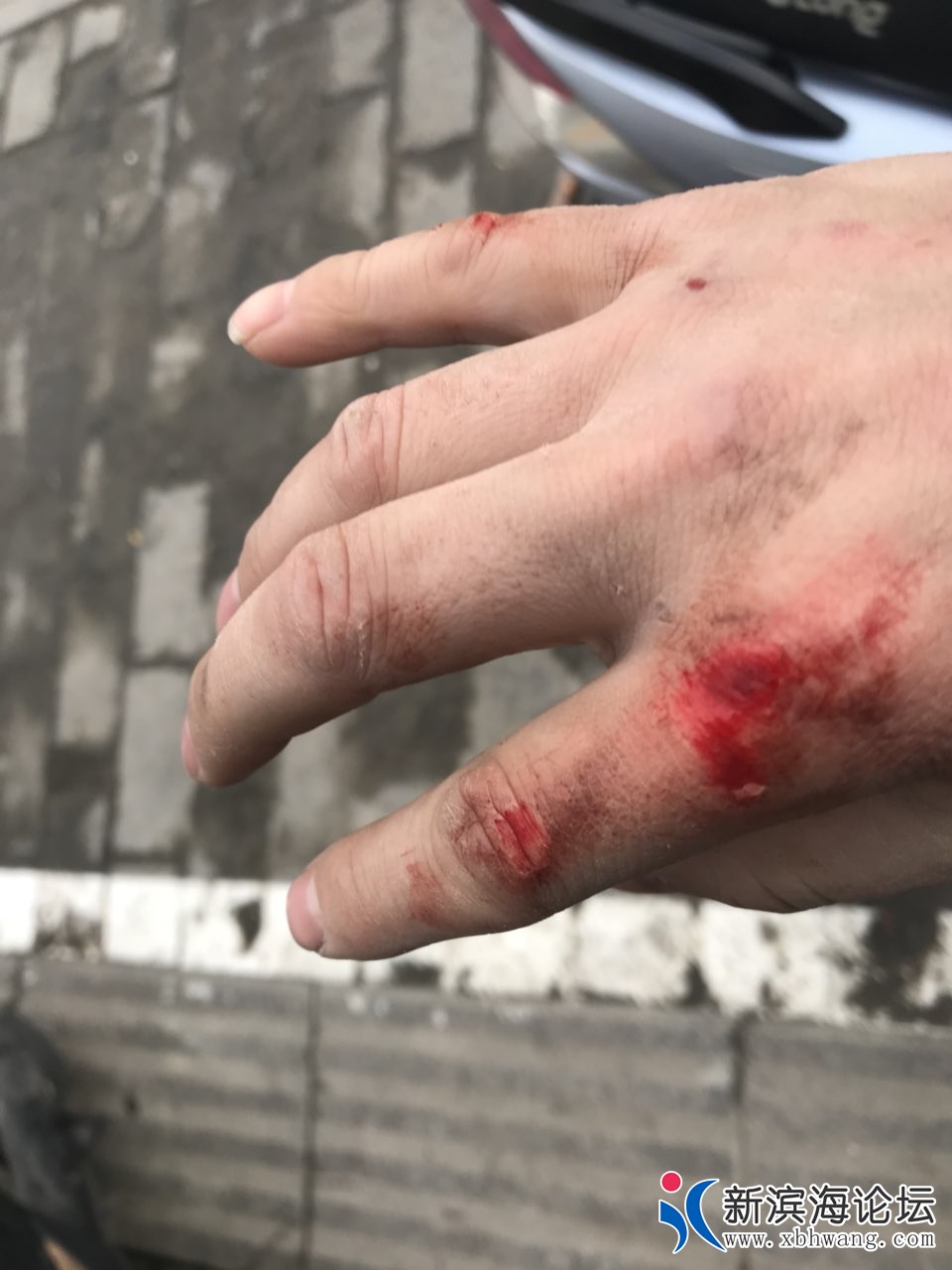 161012gj1xdnzxz62yypeu.jpg