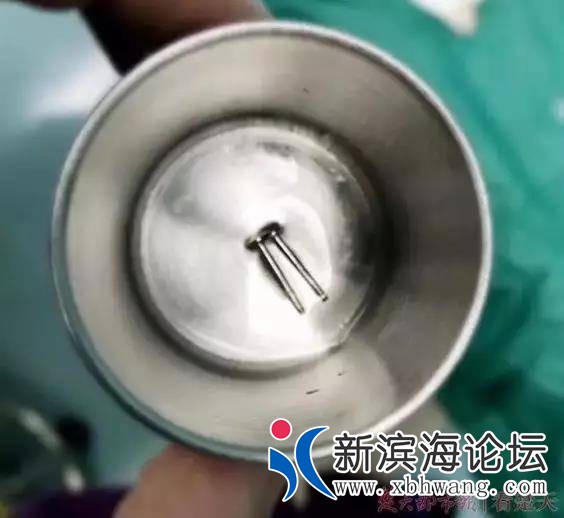 150159uxbk0x7003mvabkb.jpg.thumb.jpg