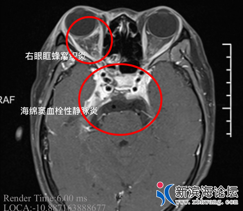 微信图片_20200907153316.png