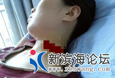 u=1717073336,3893015067&amp;fm=26&amp;gp=0.jpg