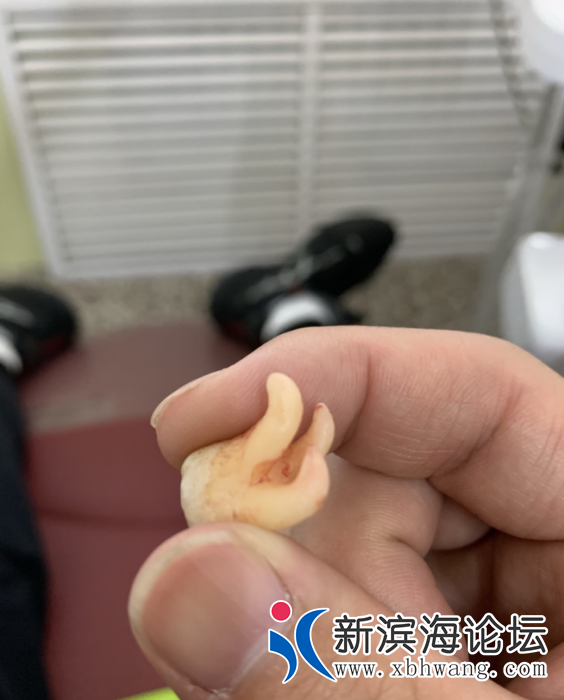 163013gjlpfmr3q1zfpvns.png.thumb.jpg
